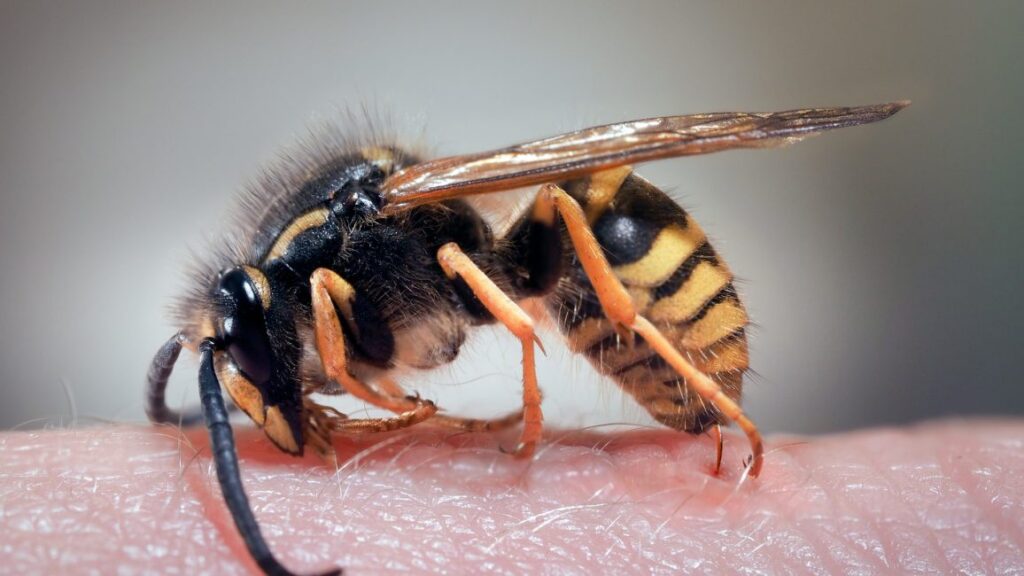 wasp-sting-treatment